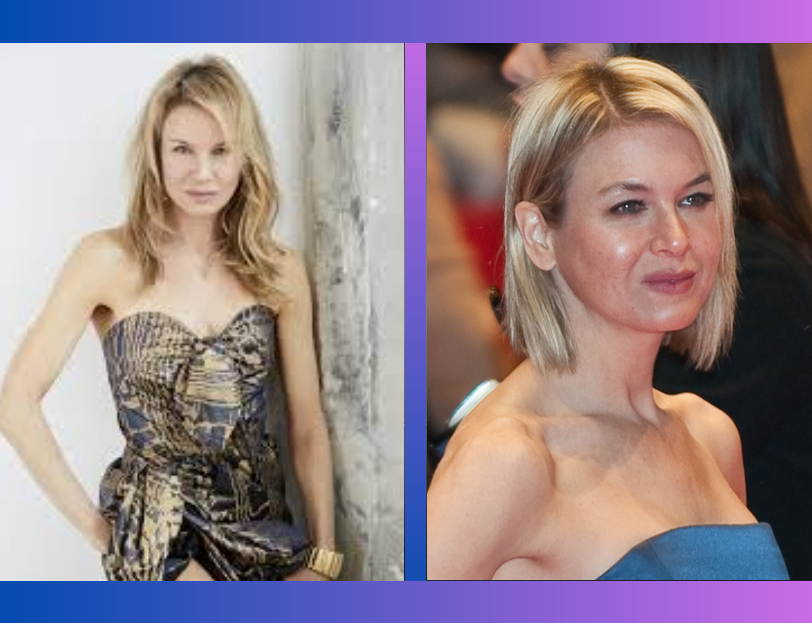 renee zellweger age